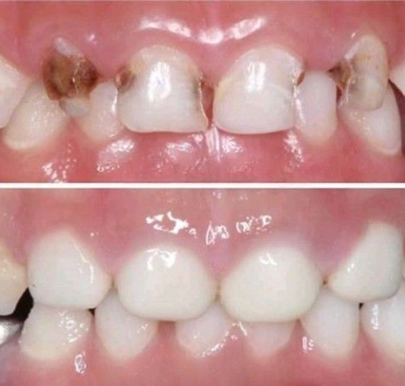 pediatric-dental-checkup.png
