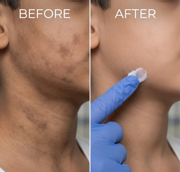 pigmentation-kid.png