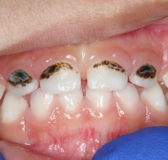 pediatric-dental-checkup.png