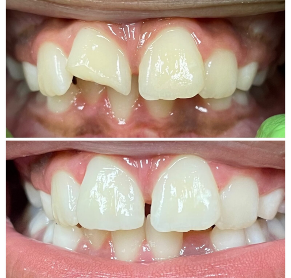 teeth-cleaning-kid.png