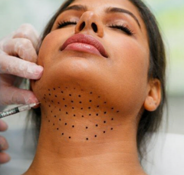 lipolysis-injections.png
