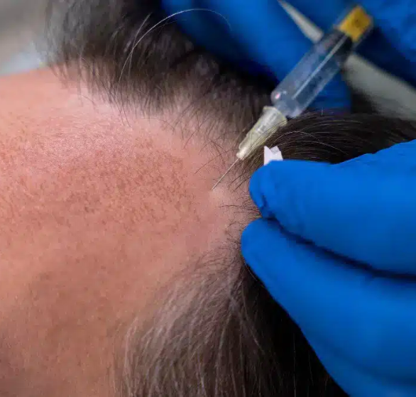 artificial-hair-fibers.png